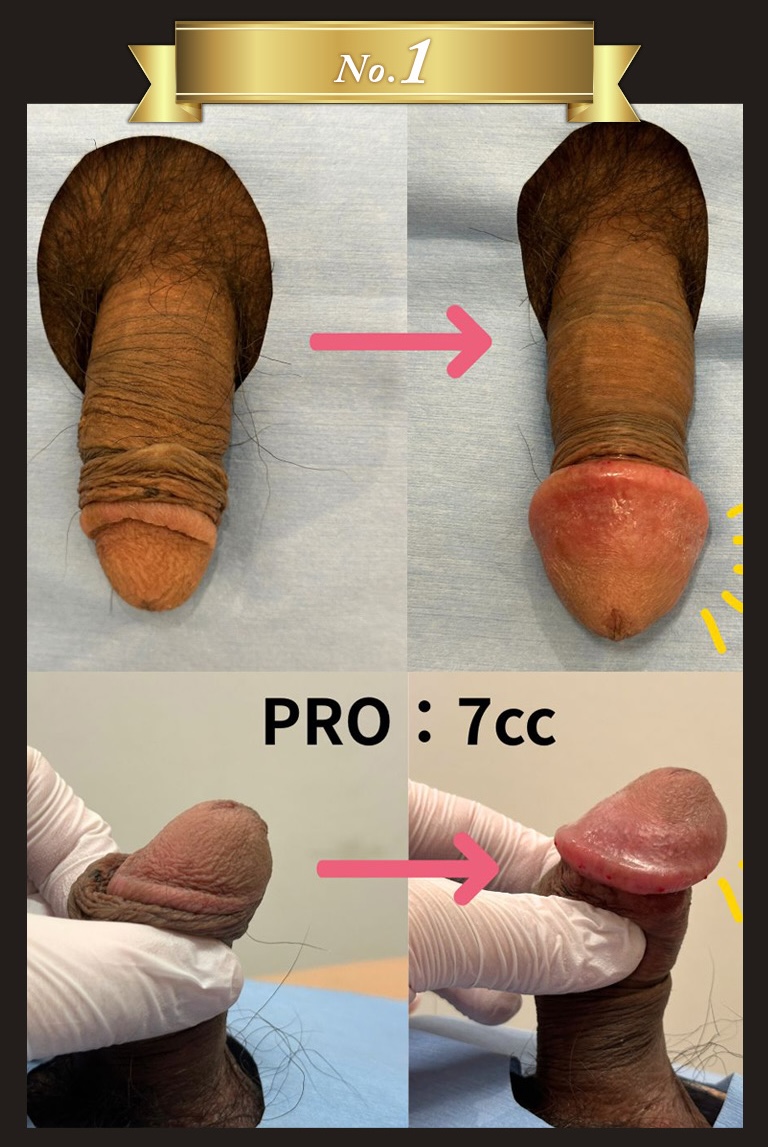 「あの手術さえしなければ・・・」その失敗、私が引き受けます！