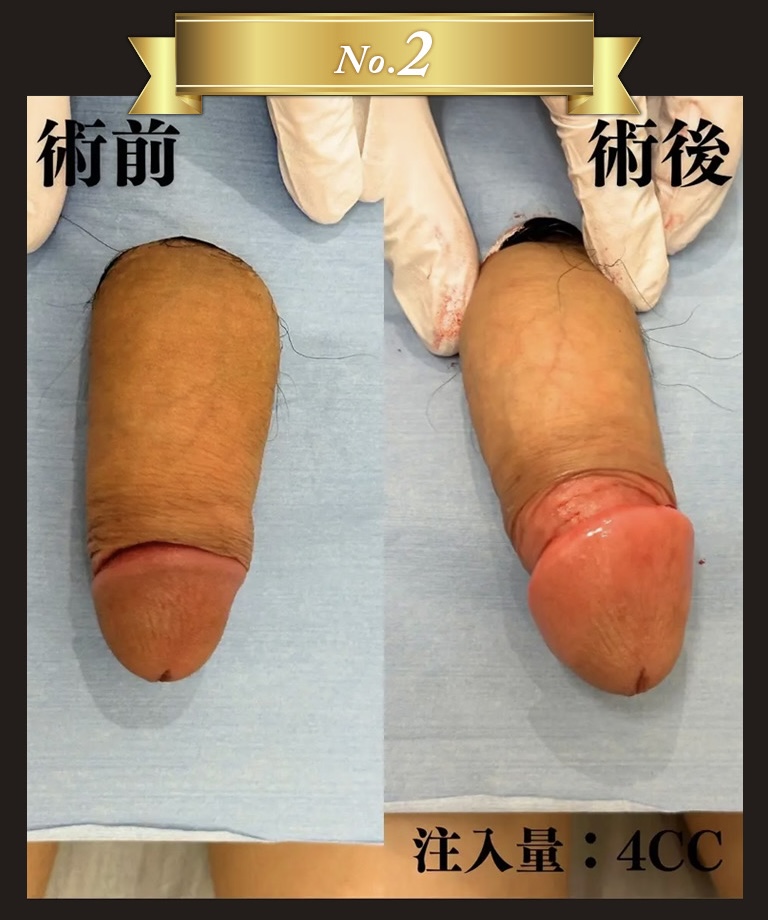 「あの手術さえしなければ・・・」その失敗、私が引き受けます！