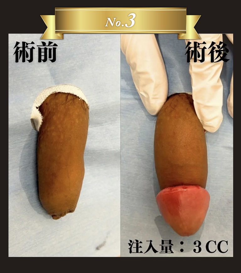 「あの手術さえしなければ・・・」その失敗、私が引き受けます！