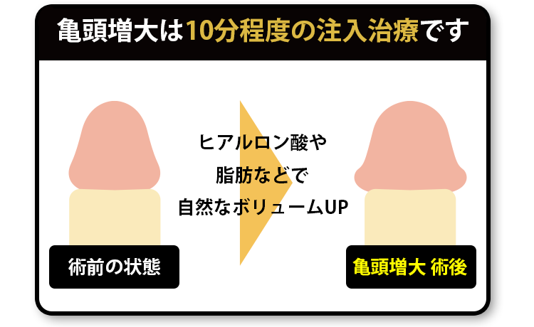 亀頭増大は10分程度の注入治療です