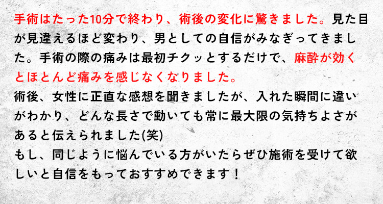 手術はたった10分で終わり、術後の変化に驚きました
