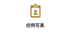 症例