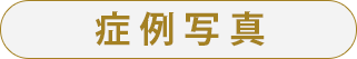 症例写真