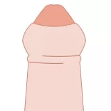仮性包茎について