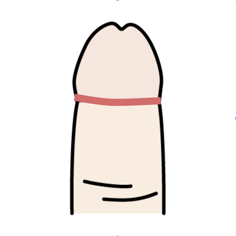 カントン包茎のイラスト