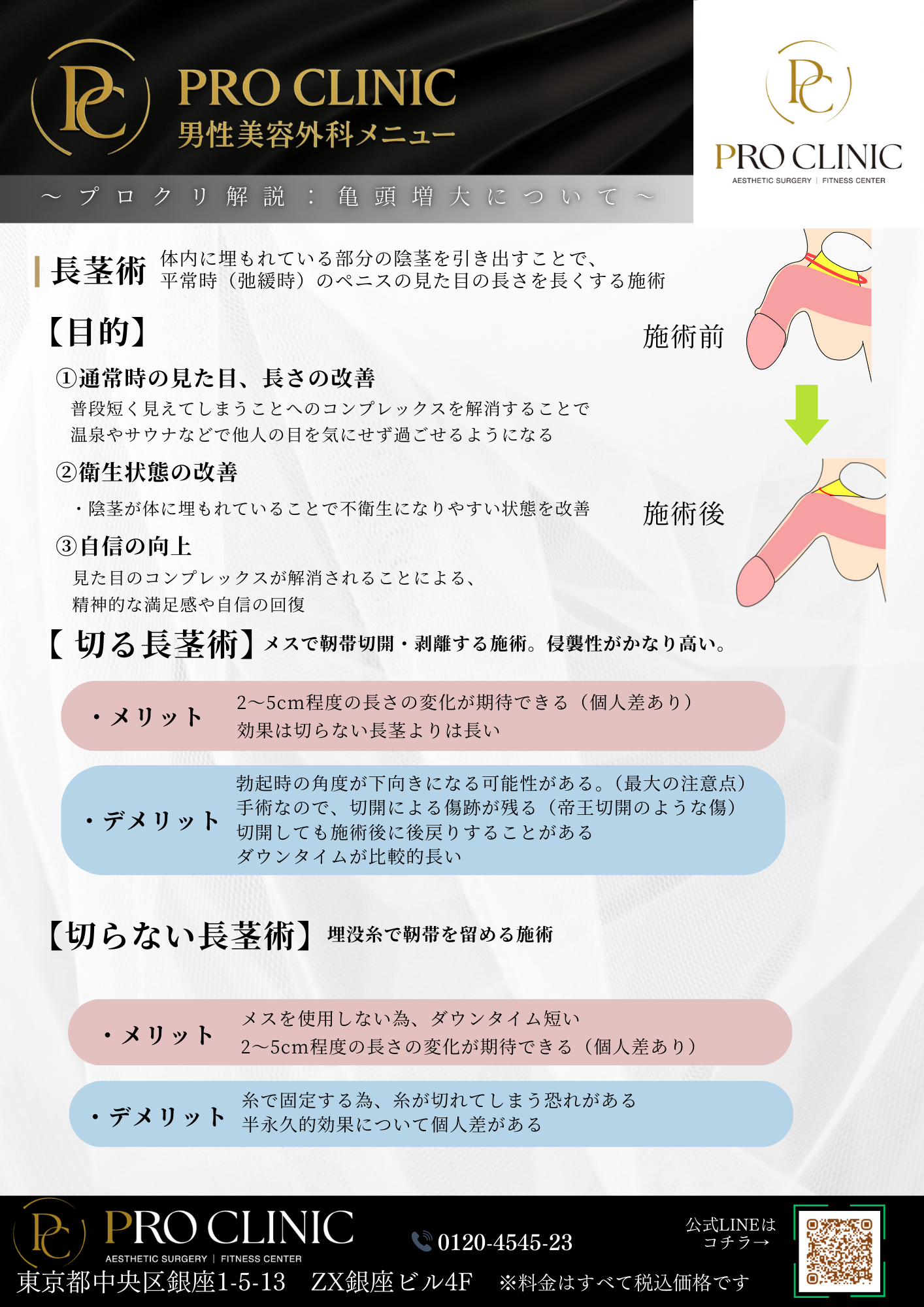 よくある質問(痛み・ダウンタイム・持続期間など)