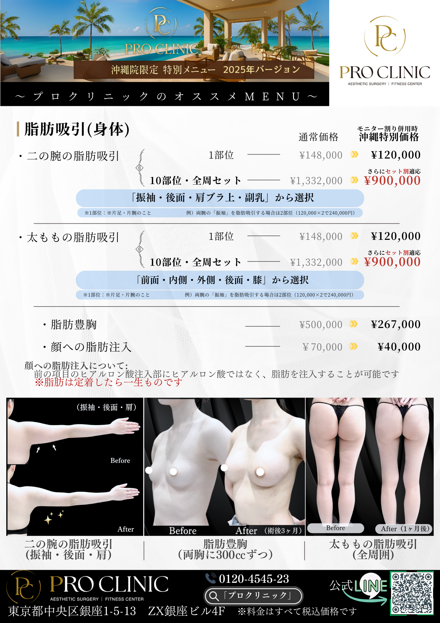 糸リフト 症例ハイライト:フェイスラインの引き上げ事例