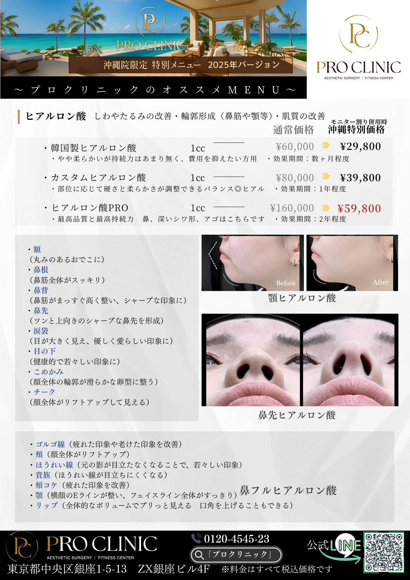 ボトックス(韓国製/米国製)100単位打ち放題 キャンペーン