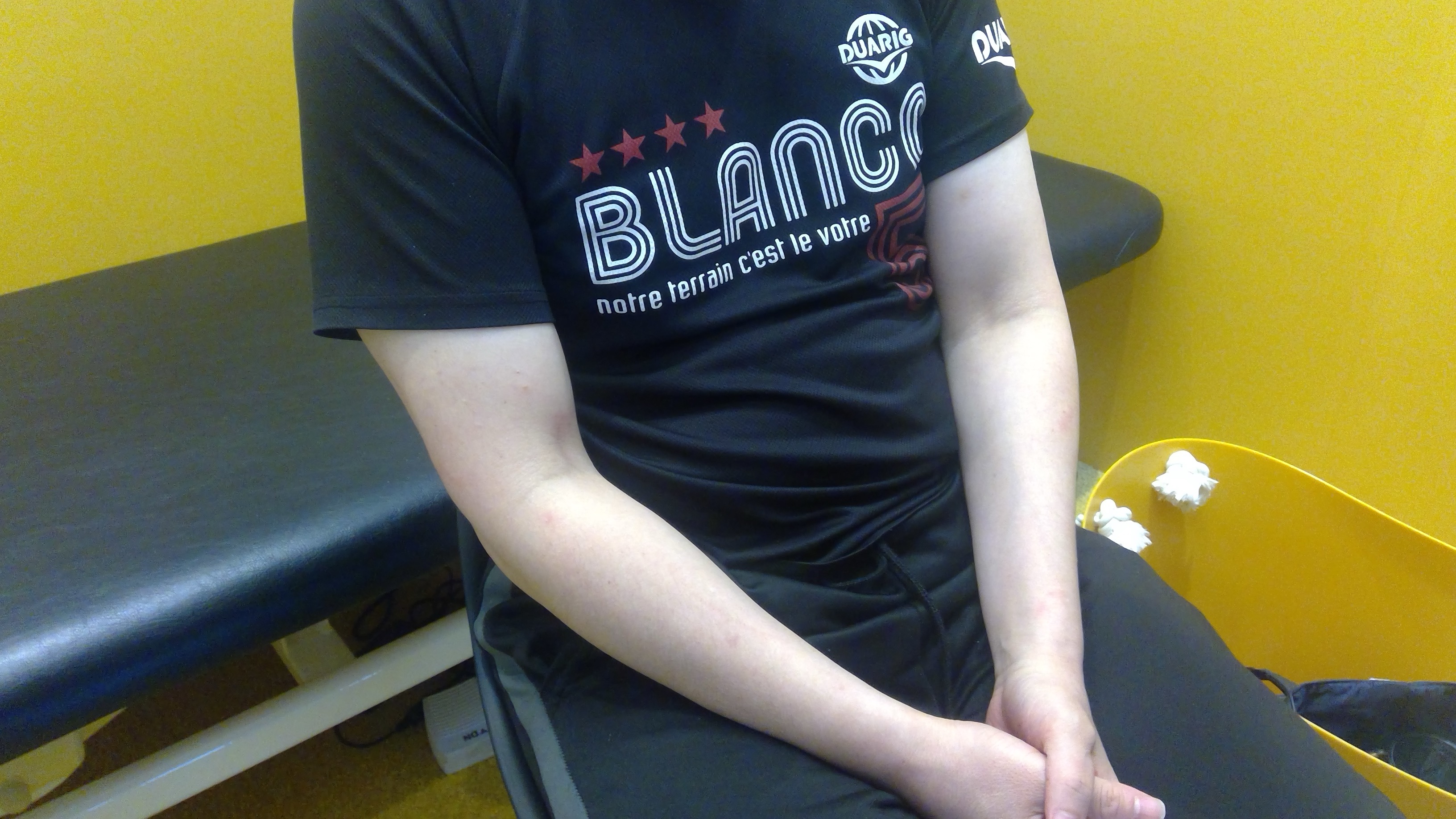 亀頭増大ヒアルロン酸注入の術後写真|サイズアップと性行為満足度改善