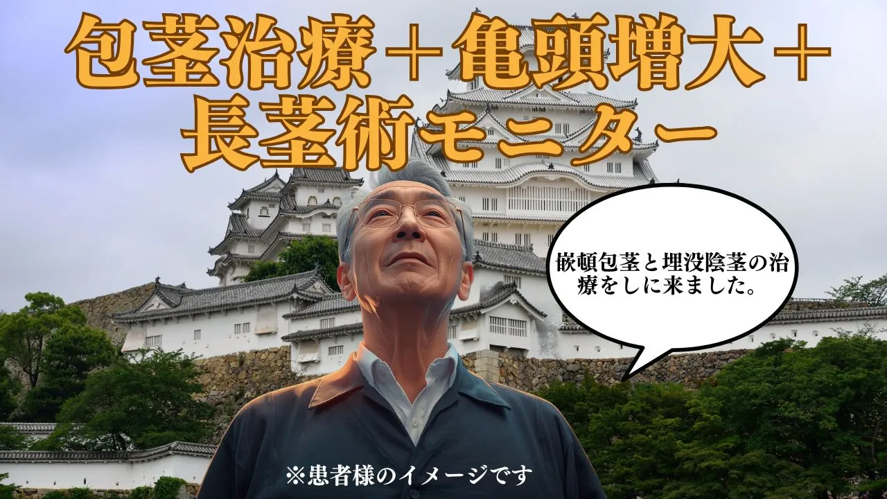 埋没陰茎と嵌頓包茎の複合治療症例。切らない長茎術で陰茎を引き出し、包茎手術で締め付けを解消。ヒアルロン酸1ccで亀頭を整えた術前術後の比較写真。