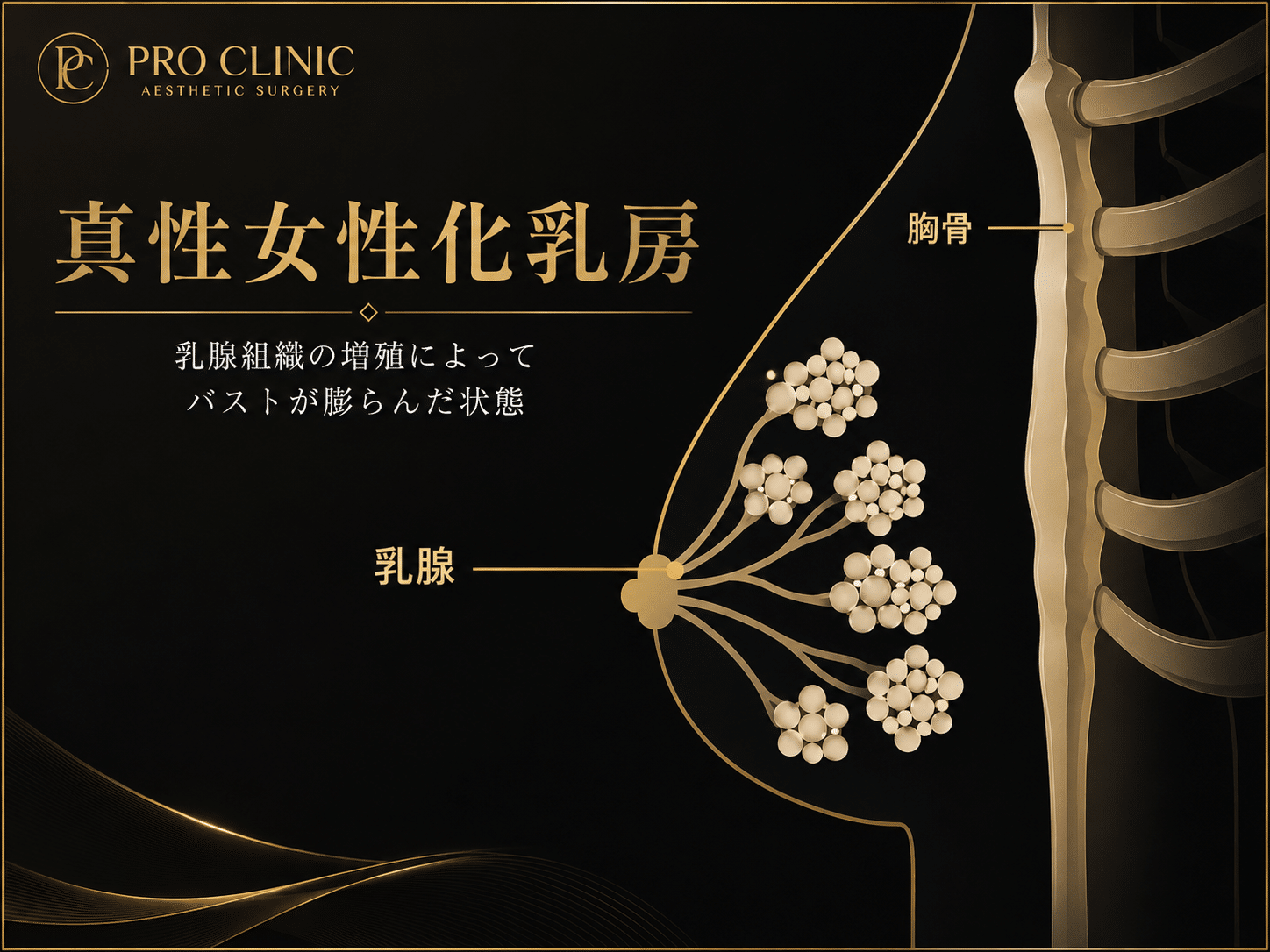 真性女性化乳房の解剖図 真性女性化乳房を示す図