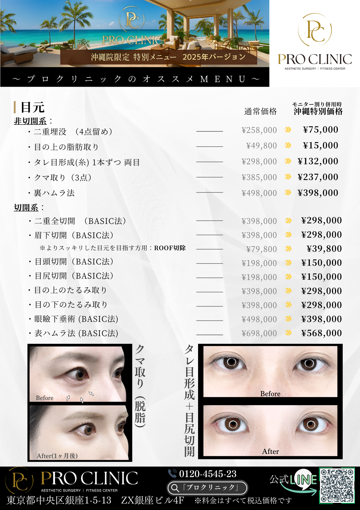 糸リフト PDO/PCLの特徴と選び方(自然なリフトアップ)