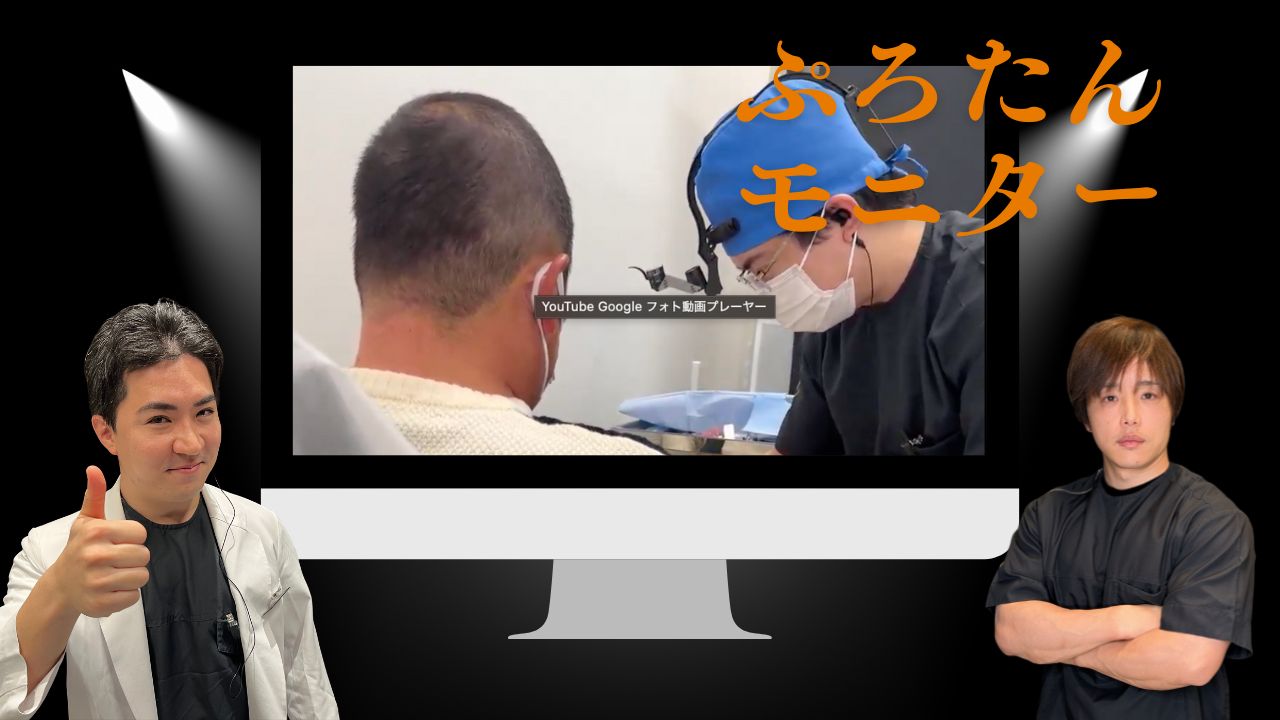 長茎術トライデントと亀頭増大PRO5ccを行った男性器のビフォーアフター症例写真